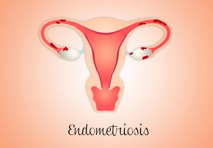 Fonte: Medicalnewstoday