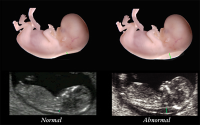 Imagem: fetal.com